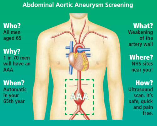 Abdominal Aortic Aneurysm screening