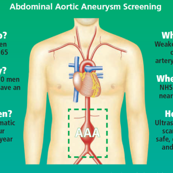 Abdominal Aortic Aneurysm screening